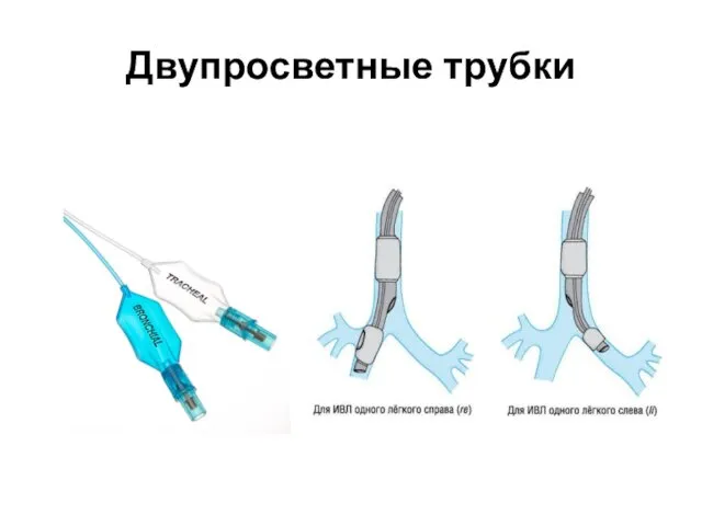 Двупросветные трубки