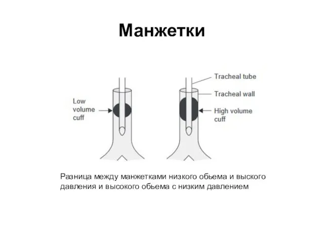 Манжетки Разница между манжетками низкого обьема и выского давления и высокого обьема с низким давлением