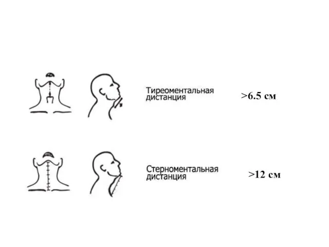 >12 см >6.5 см