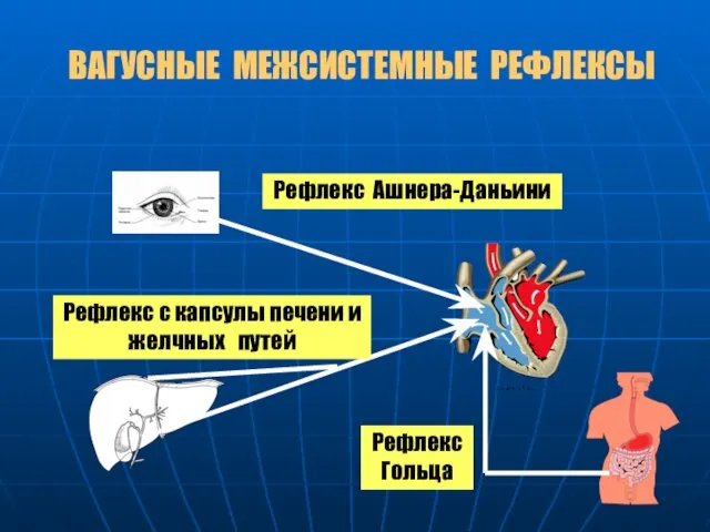 ВАГУСНЫЕ МЕЖСИСТЕМНЫЕ РЕФЛЕКСЫ Рефлекс Ашнера-Даньини Рефлекс с капсулы печени и желчных путей Рефлекс Гольца