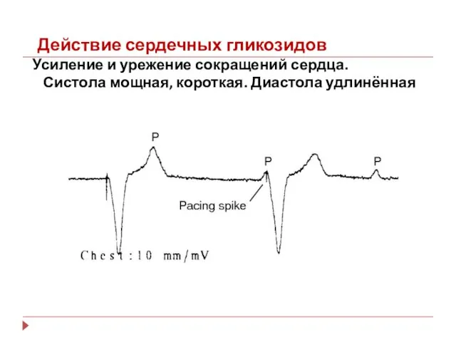 Действие сердечных гликозидов Усиление и урежение сокращений сердца. Систола мощная, короткая. Диастола удлинённая