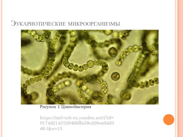 Эукариотические микроорганизмы Рисунок 1 Цианобактерия https://im0-tub-ru.yandex.net/i?id=8174d21437d9466ffa59cd29ea6dd0d6-l&n=13