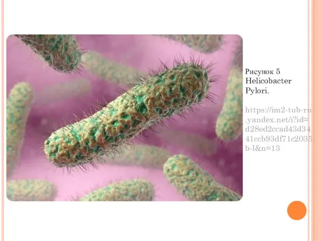 Рисунок 5 Helicobacter Pylori. https://im2-tub-ru.yandex.net/i?id=d28ed2ccad43d3441ccb93df71c2035b-l&n=13