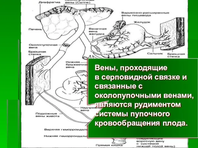 Вены, проходящие в серповидной связке и связанные с околопупочными венами, являются рудиментом системы пупочного кровообращения плода.