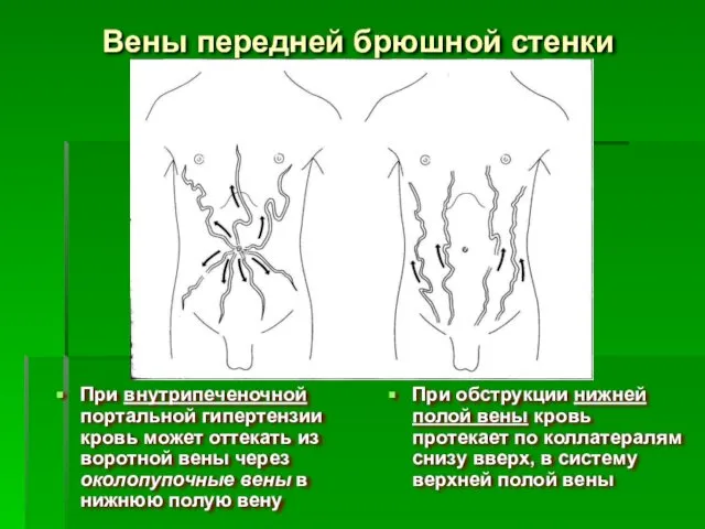 Вены передней брюшной стенки При внутрипеченочной портальной гипертензии кровь может оттекать