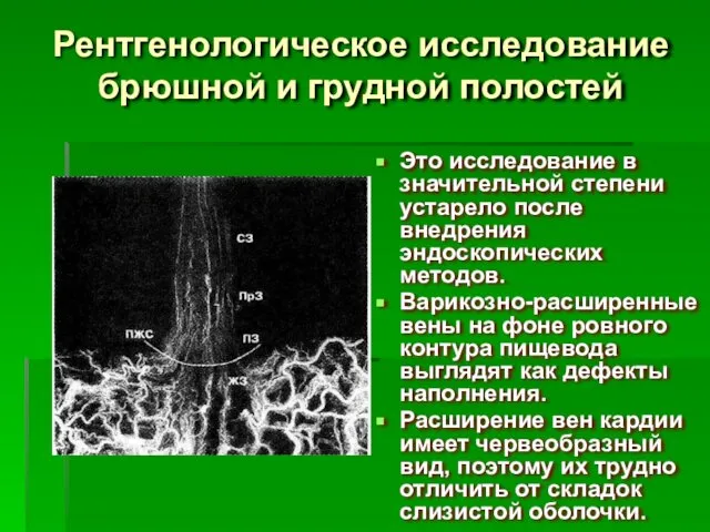 Рентгенологическое исследование брюшной и грудной полостей Это исследование в значительной степени