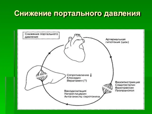 Снижение портального давления