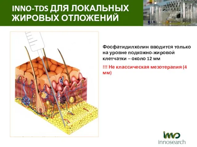 Фосфатидилхолин вводится только на уровне подкожно-жировой клетчатки – около 12 мм