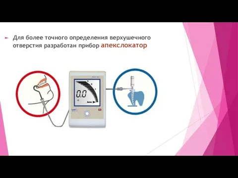 Для более точного определения верхушечного отверстия разработан прибор апекслокатор