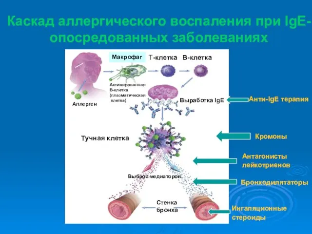 Каскад аллергического воспаления при IgE- опосредованных заболеваниях Выработка IgE T-клетка B-клетка