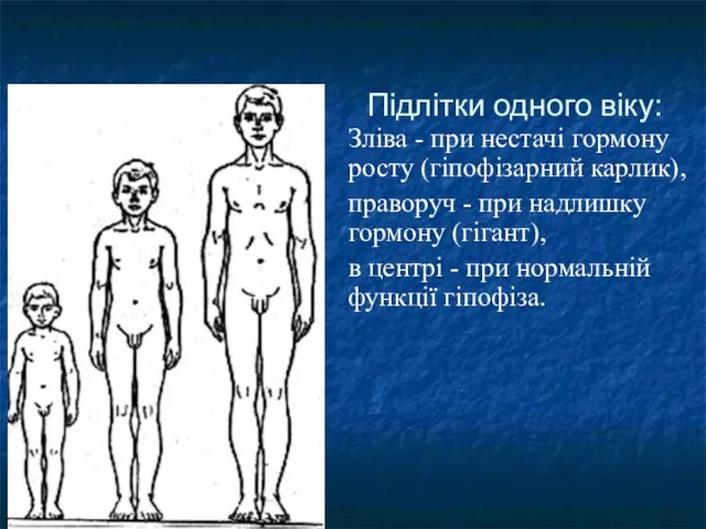 Підлітки одного віку: Зліва - при нестачі гормону росту (гіпофізарний карлик),