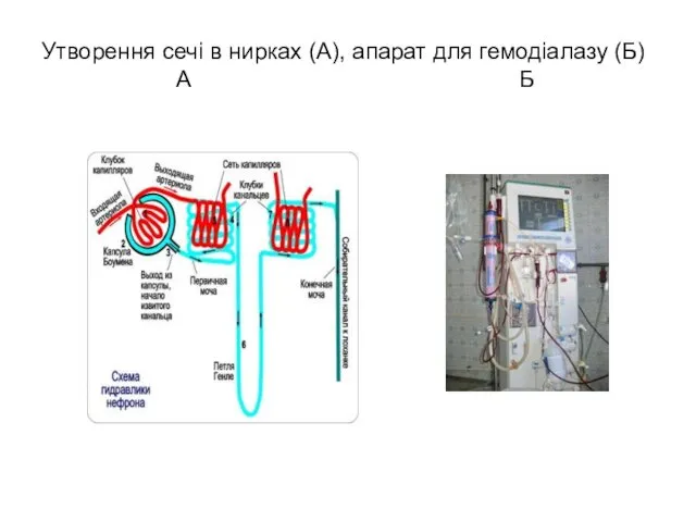 Утворення сечі в нирках (А), апарат для гемодіалазу (Б) А Б