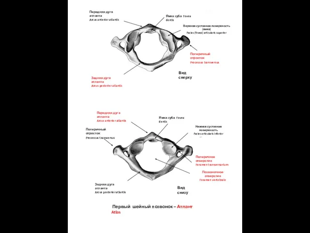 Первый шейный позвонок – Атлант Atlas Вид сверху Вид снизу Ямка