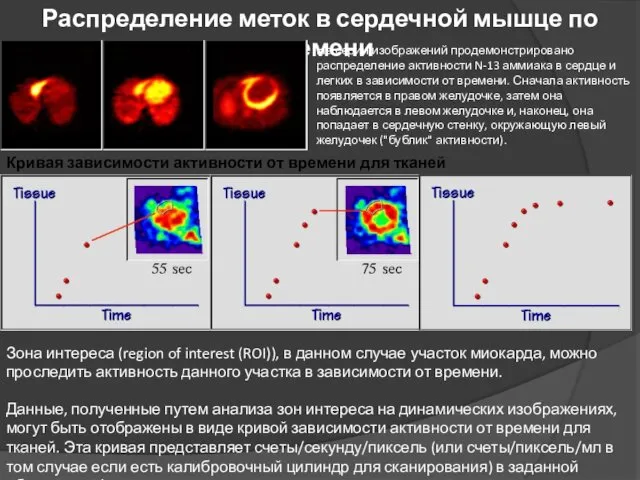 Распределение меток в сердечной мышце по времени На серии изображений продемонстрировано