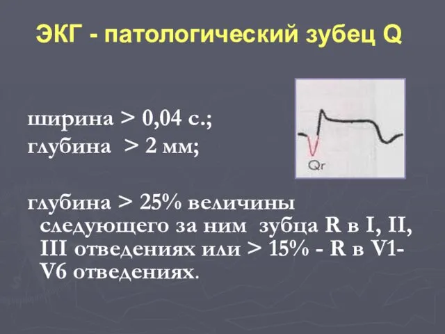 ширина > 0,04 с.; глубина > 2 мм; глубина > 25%