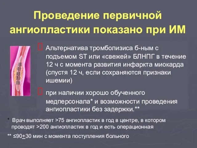 Проведение первичной ангиопластики показано при ИМ Альтернатива тромболизиса б-ным с подъемом