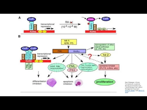New Strategies in Acute Promyelocytic Leukemia: Moving to an Entirely Oral,