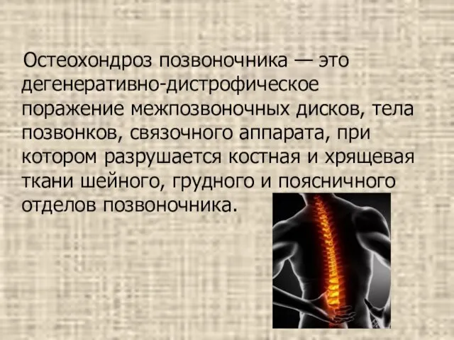 Остеохондроз позвоночника — это дегенеративно-дистрофическое поражение межпозвоночных дисков, тела позвонков, связочного