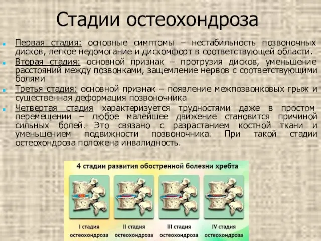 Стадии остеохондроза Первая стадия: основные симптомы – нестабильность позвоночных дисков, легкое