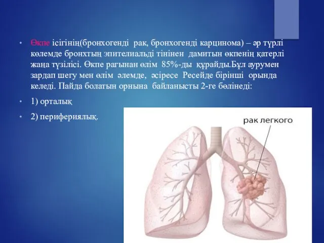 Өкпе ісігінің(бронхогенді рак, бронхогенді карцинома) – әр түрлі көлемде бронхтың эпителиальді