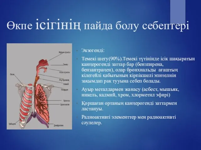 Өкпе ісігінің пайда болу себептері Экзогенді: Темекі шегу(90%).Темекі түтінінде ісік шақыратын