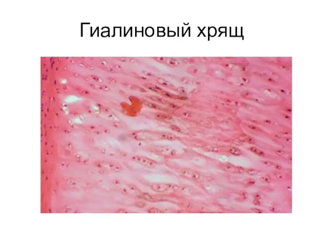 Гиалиновый хрящ