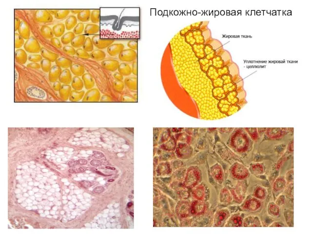 Подкожно-жировая клетчатка