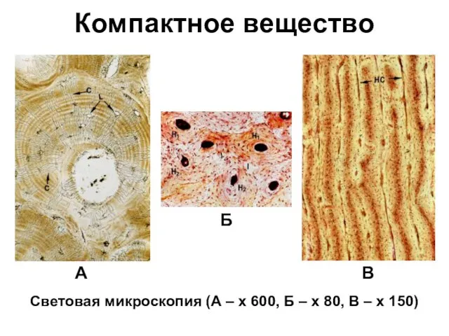 Световая микроскопия (А – х 600, Б – х 80, В