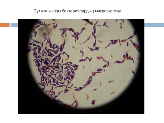 Сүтқышқылды бактериялардың микроскоптау