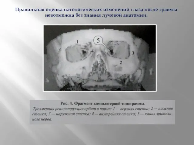 Правильная оценка патологических изменений глаза после травмы невозможна без знания лучевой анатомии.