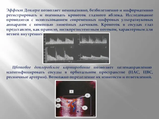 Эффект Доплера позволяет неинвазивно, безболезненно и информативно регистрировать и оценивать кровоток