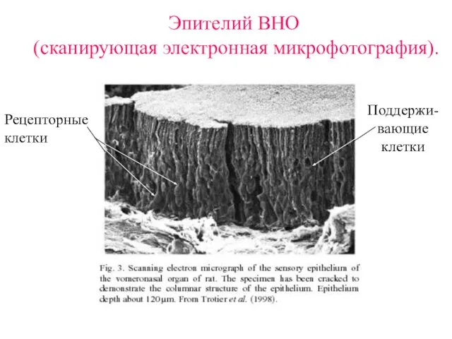 Эпителий ВНО (сканирующая электронная микрофотография). Рецепторные клетки Поддержи-вающие клетки