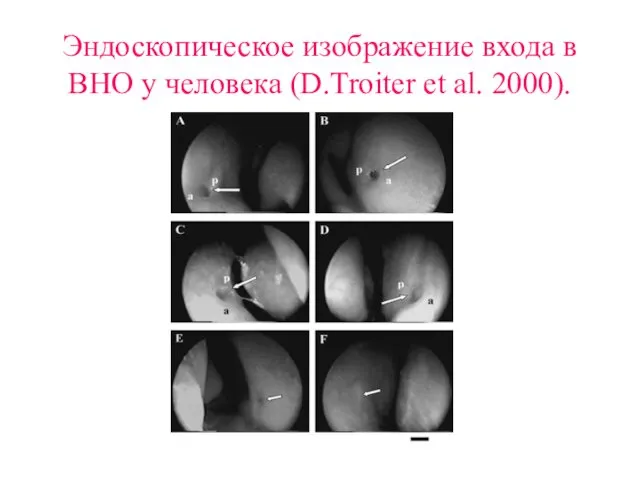 Эндоскопическое изображение входа в ВНО у человека (D.Troiter et al. 2000).