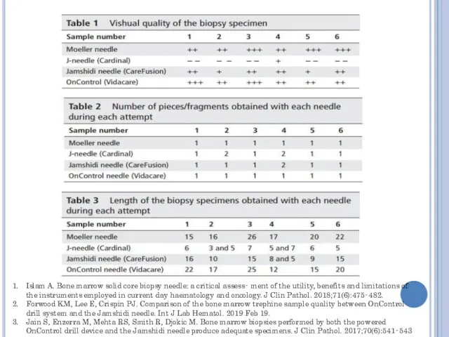 Islam A. Bone marrow solid core biopsy needle: a critical assess‐