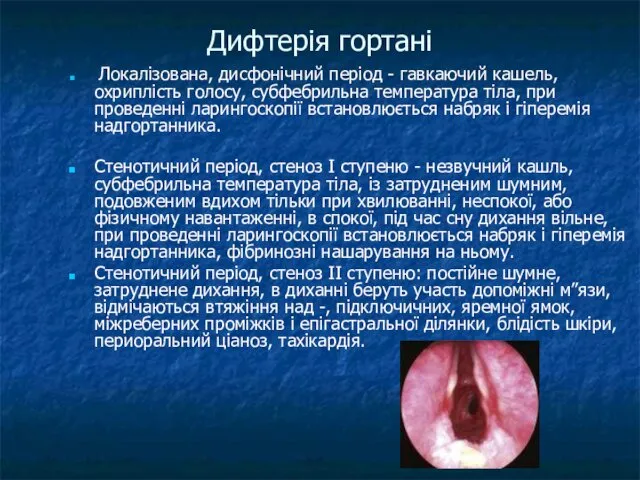 Дифтерія гортані Локалізована, дисфонічний період - гавкаючий кашель, охриплість голосу, субфебрильна