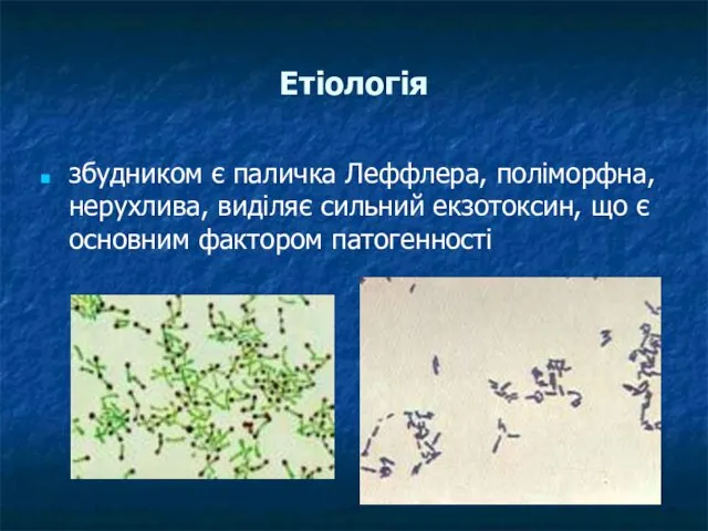 Етіологія збудником є паличка Леффлера, поліморфна, нерухлива, виділяє сильний екзотоксин, що є основним фактором патогенності