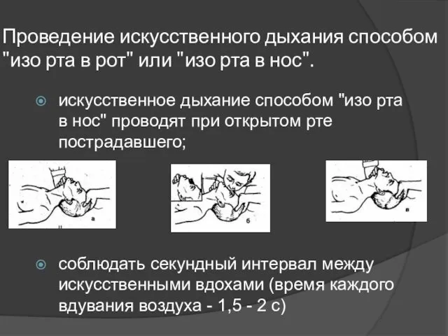 Проведение искусственного дыхания способом "изо рта в рот" или "изо рта