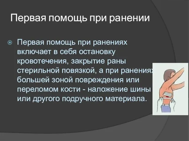 Первая помощь при ранении Первая помощь при ранениях включает в себя