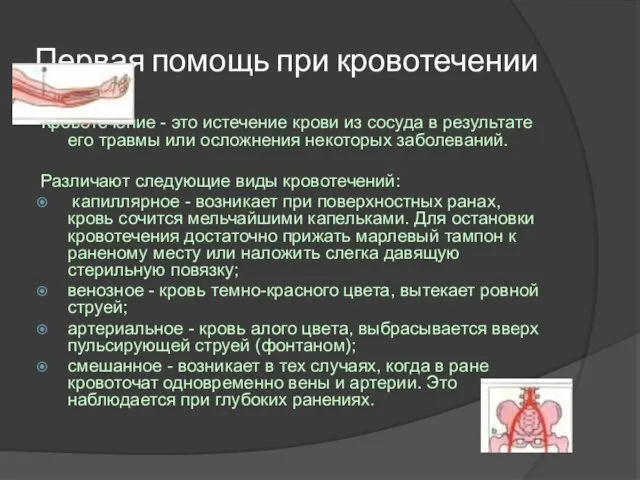 Первая помощь при кровотечении Кровотечение - это истечение крови из сосуда