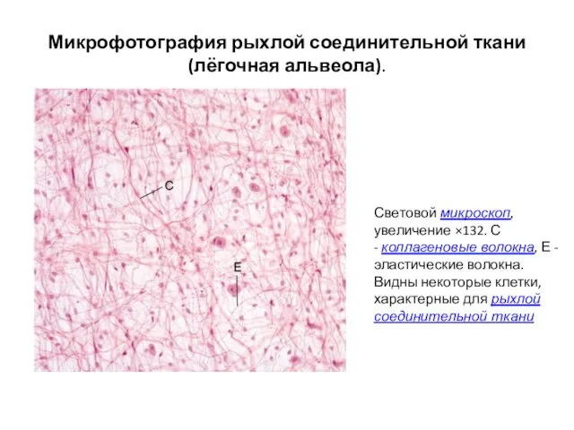 Микрофотография рыхлой соединительной ткани (лёгочная альвеола). Световой микроскоп, увеличение ×132. С
