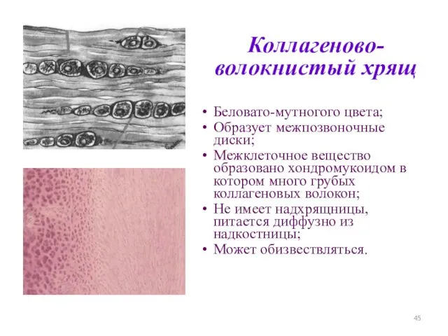 Коллагеново- волокнистый хрящ Беловато-мутногого цвета; Образует межпозвоночные диски; Межклеточное вещество образовано