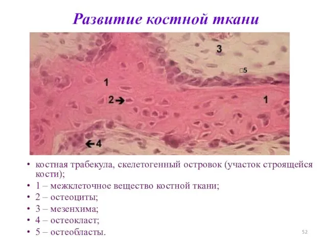 Развитие костной ткани костная трабекула, скелетогенный островок (участок строящейся кости); 1