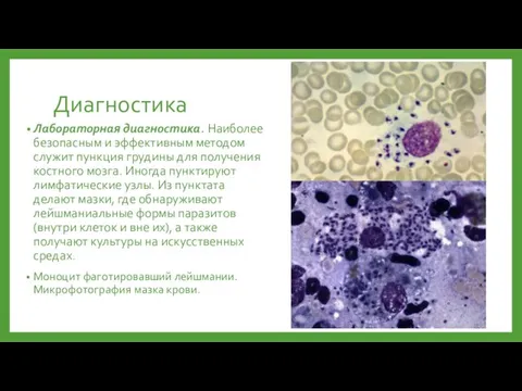 Диагностика Лабораторная диагностика. Наиболее безопасным и эффективным методом служит пункция грудины