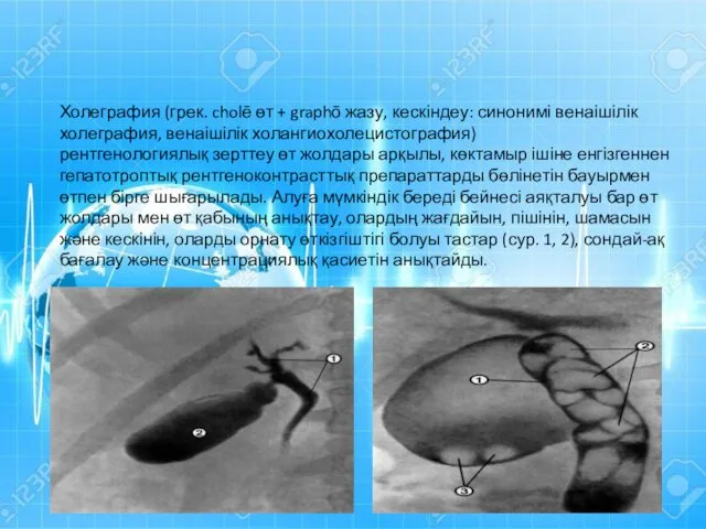 Холеграфия (грек. cholē өт + graphō жазу, кескіндеу: синонимі венаішілік холеграфия,