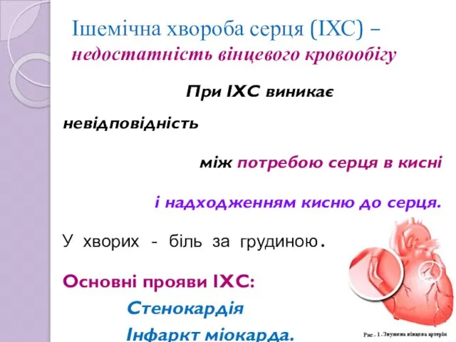 Ішемічна хвороба серця (ІХС) – недостатність вінцевого кровообігу При ІХС виникає