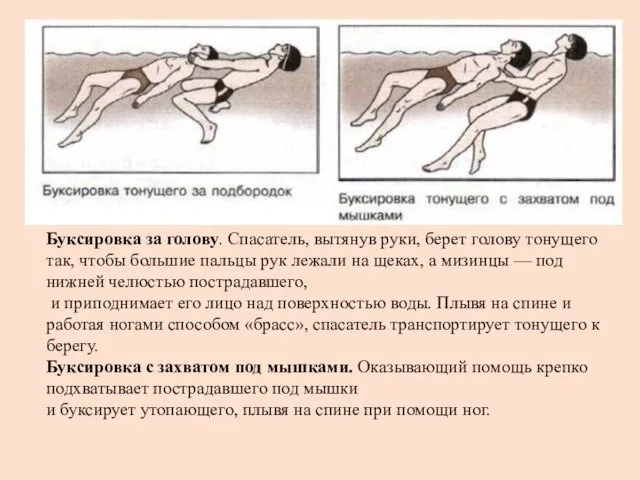 Буксировка за голову. Спасатель, вытянув руки, берет голову тонущего так, чтобы