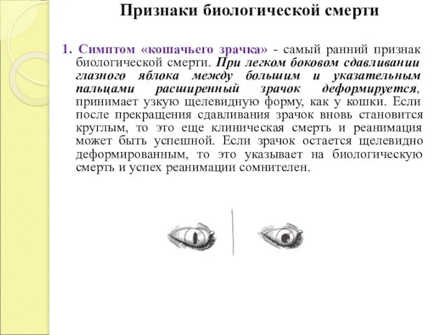 Признаки биологической смерти 1. Симптом «кошачьего зрачка» - самый ранний признак