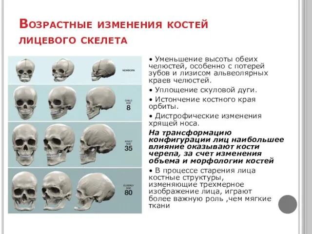 Возрастные изменения костей лицевого скелета • Уменьшение высоты обеих челюстей, особенно