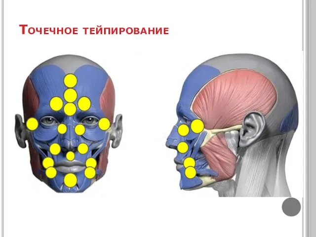 Точечное тейпирование