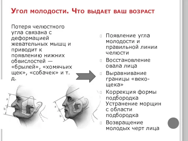 Угол молодости. Что выдает ваш возраст Появление угла молодости и правильной